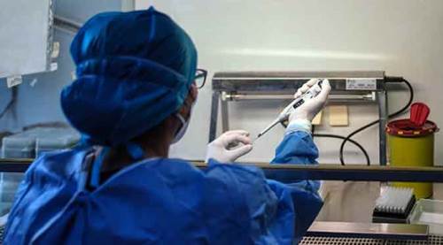 Türkiye’de son durum: Vakalar düşüyor, ölümler artıyor!