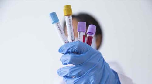 Türkiye'de vaka ve ölü sayısı kaça yükseldi?