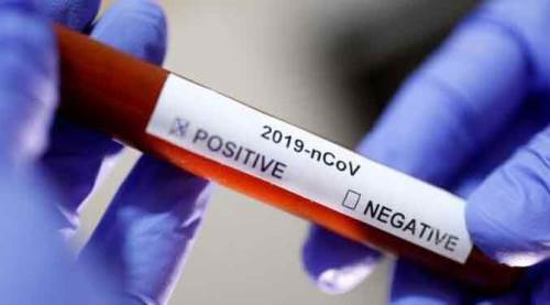 Türkiye'deki son durumu Bakan Koca açıkladı