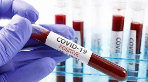 Türkiye’deki son veriler açıklandı!