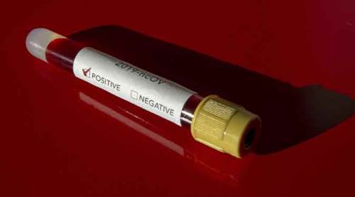 Türkiye koronavirüsten can kaybı sayısı 356'ya yükseldi! Son dakika