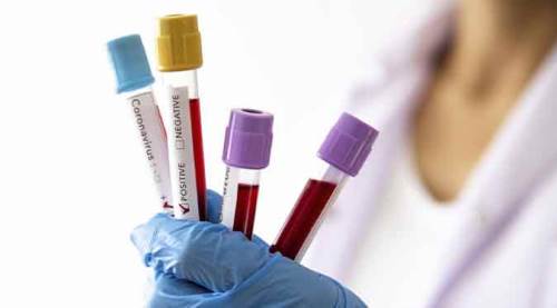 Türkiye'nin bugünkü vaka sayısındaki artış...