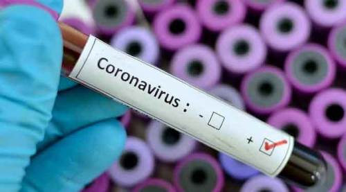 Türkiye'nin günlük koronavirüs verileri açıklandı 