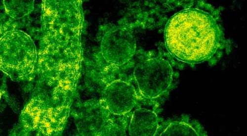 Türkiye'nin koronavirüs günlüğünde son durum