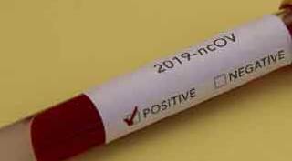 Türkiye'nin koronavirüs tablosu: 16 Haziran 2020