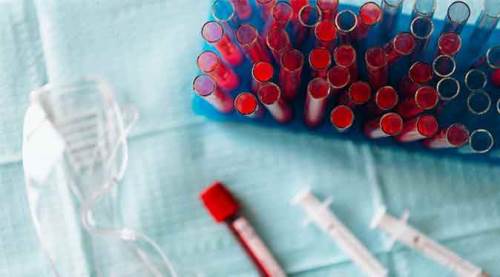 Türkiye'nin koronavirüs tablosunda 25 Nisan 2022