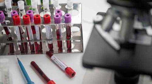 Türkiye'nin koronavirüs tablosunda bugün...