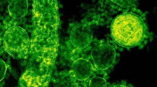 Türkiye'nin koronavirüste son 24 saati...