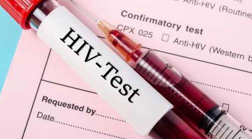 Türkiye'yi sarsan olay: AIDS'li damat adayının iğrenç planı!