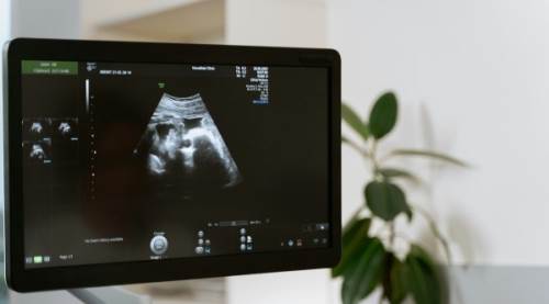 Ultrasonda “GA” ne demek?