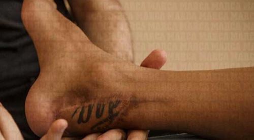 Ünlü futbolcunun ayağı bu halde!