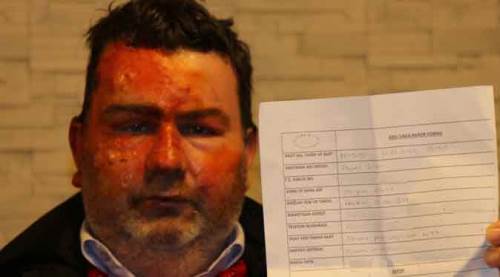 Uyurken dehşeti yaşadı: Yüzü tanınmaz hale geldi!