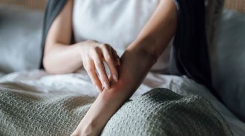 Uyuz Belirtileri Nelerdir? Erken Teşhis ve Tedavi Yolları (2025 Güncel)