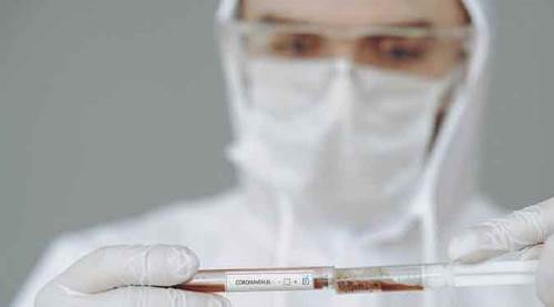 Vaka sayılarında bugün korkutan artış!