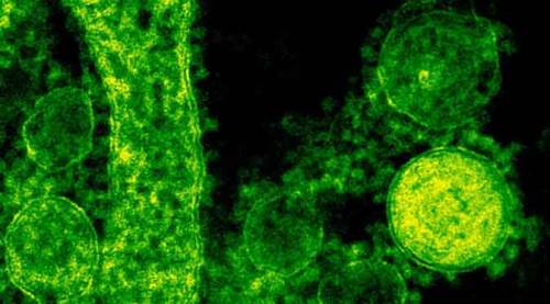 Vaka sayılarında günlük 66 bin de aşıldı!