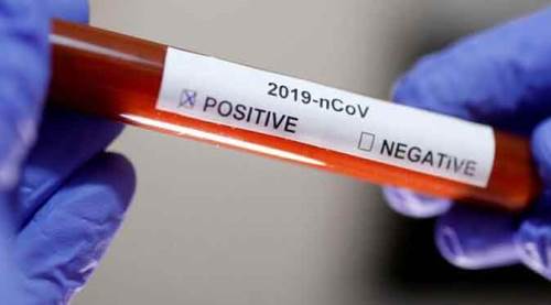 Vaka sayılarında yaşanan artış düne göre...