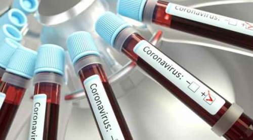 Vaka sayısında düşüş sürüyor!