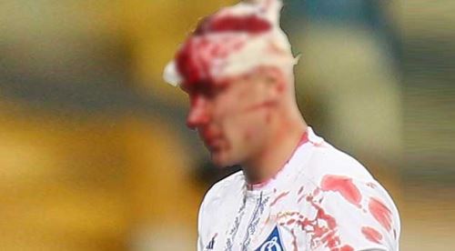 Vida kanlar içinde kaldı!