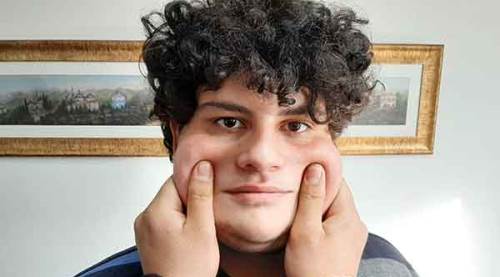 Yanaktan 'makas almak' tazminat sebebi