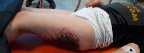 Yanan çocukların ailelerinden tepki! Açıklama utanç verici...