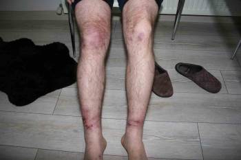 Yaş Betona Dokununca Olanlar Oldu
