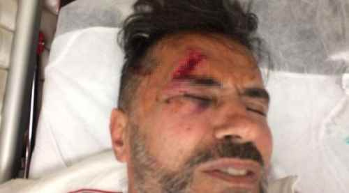 Yaşar Alptekin kaza geçirdi!