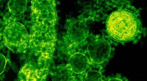 Yeni virüs kabusu! Dört ülkeye daha sıçradı