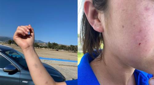 Yolda yürüyen genç kızlara dehşeti yaşattılar