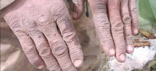 YÜKSEKOVA'DAKİ ASKER'İN ELİ