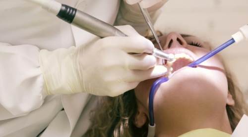 Zirkonyum Dişler Kırılır mı? Dayanıklılıkları ve Bakım Yöntemleri