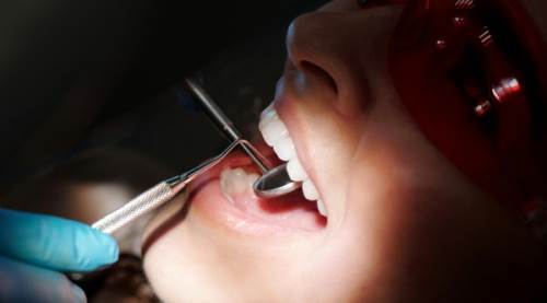 Zirkonyum Kaplama Nedir? Zararı Var Mıdır?