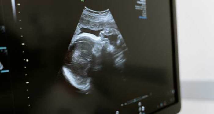 Rüyada Bebeği Ultrasonda Görmek Ne Anlama Gelir?