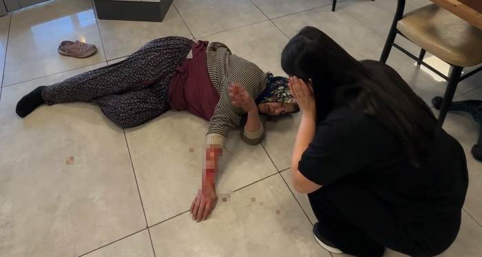 Tekmelere aldırmayan köpek kadının kolunu kopardı Tekmelere aldırmayan köpek kadının kolunu kopardı