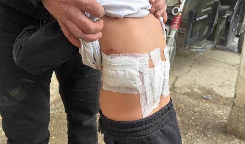 Afyon'da eşek dehşeti: 5 yaşındaki kızı tekme…