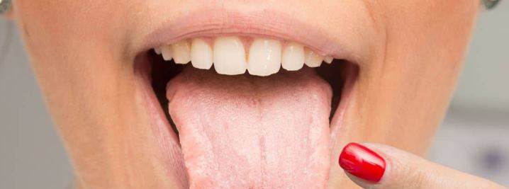 Diliniz sağlığınız hakkında önemli ipuçları v…