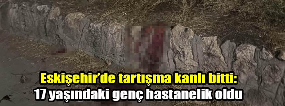 Eskişehir’de tartışma kanlı bitti: 17 yaşındaki genç hastanelik oldu