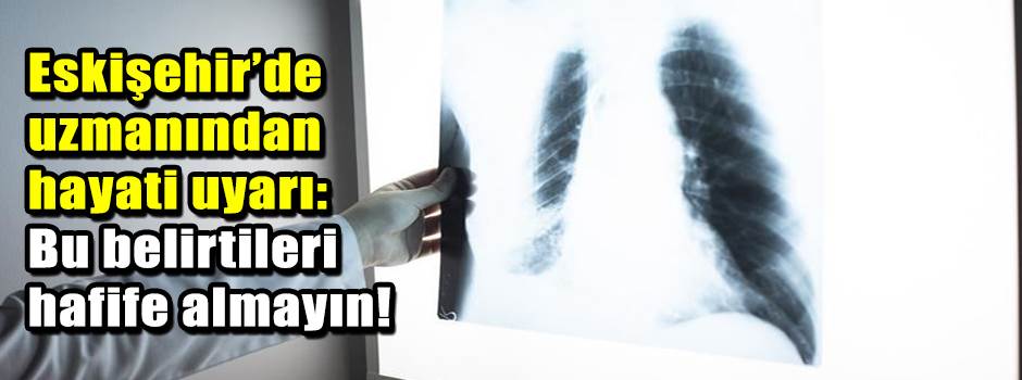 Eskişehir’de uzmanından hayati uyarı: Bu beli…