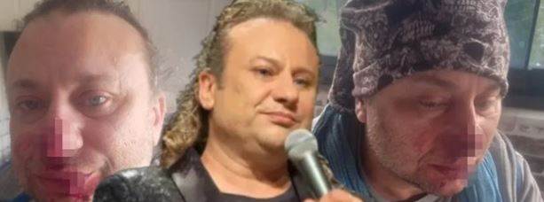 Onur Akay neden entübe edildi? “Et yiyen bakteri” iddiası sonrası dikkat çeken gelişmeler