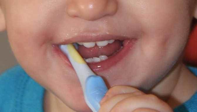 Uzmandan uyarı: Süt dişleri ihmal edilmemeli